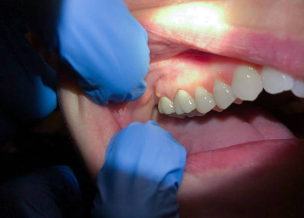 Best Urgent Dental Care for Toothache in Frontenac, KS